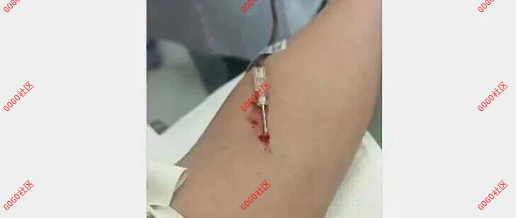 “急需O型血，请大家支援！”-GOGO社区